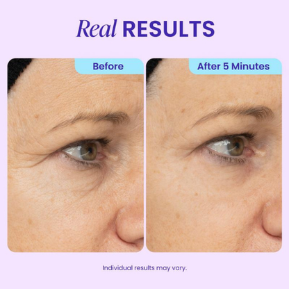PureSkin™ Instant Lift Eye Gel