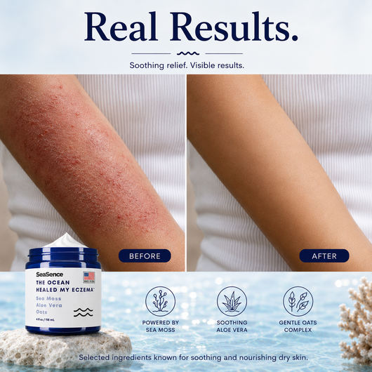Soothing Eczema Cream